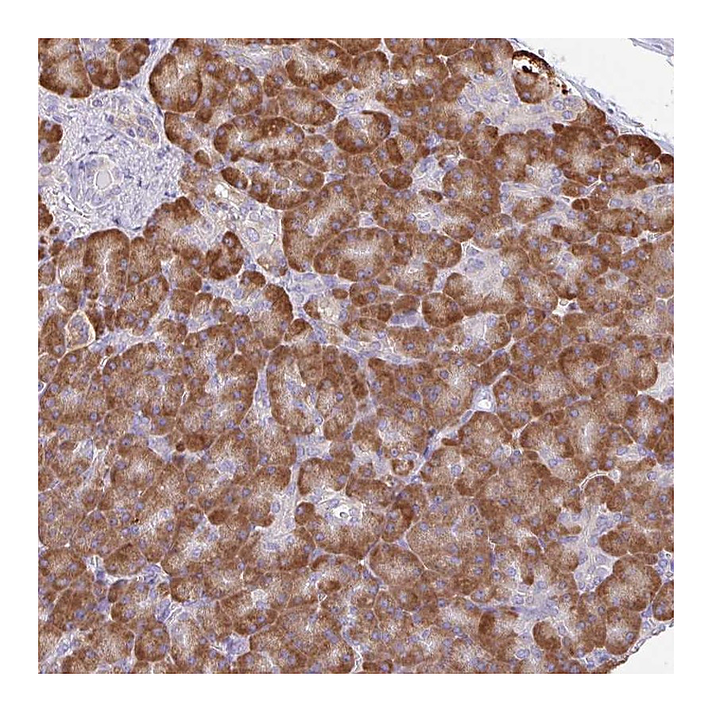 Atlas Antibodies Anti-DOK4 Antibody