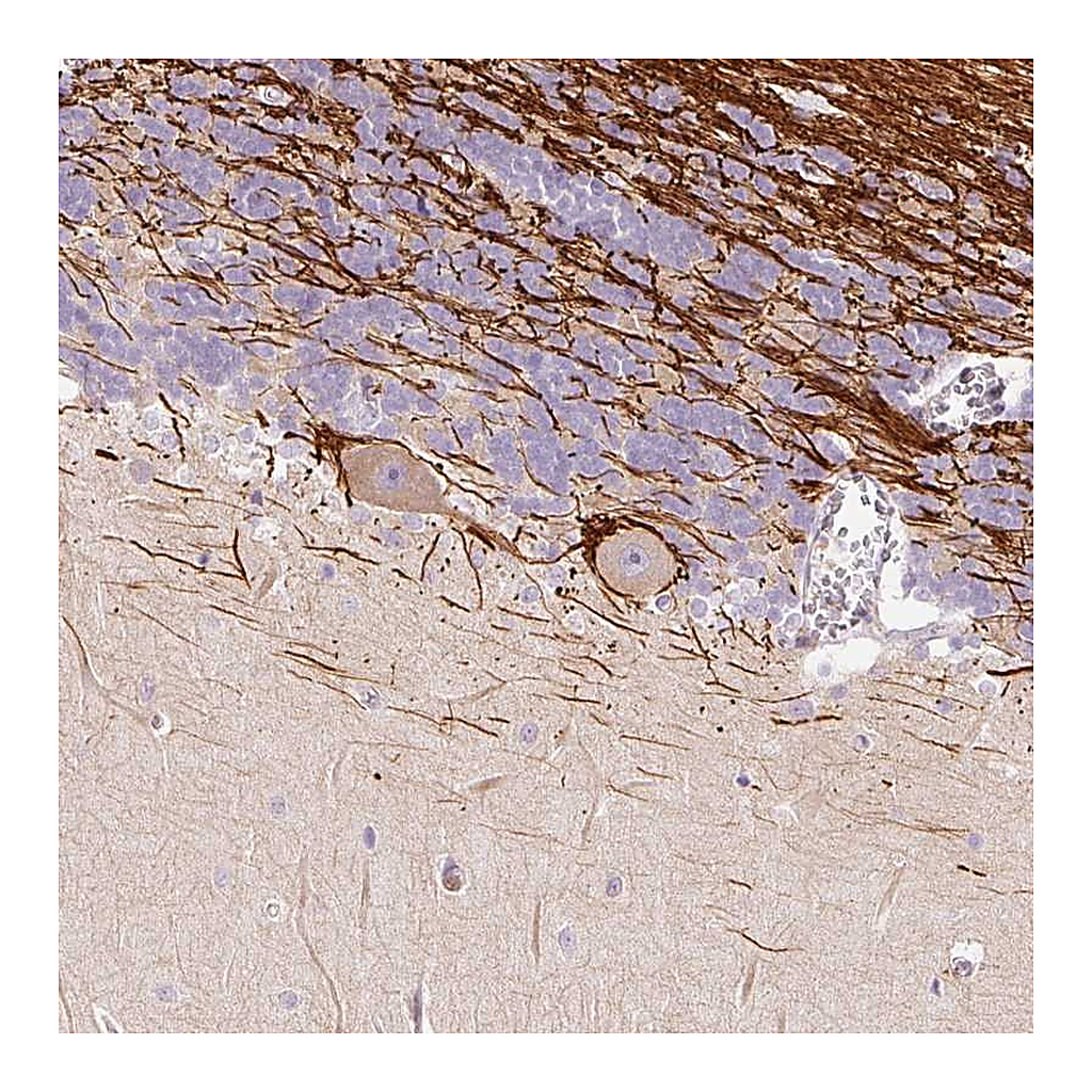 Atlas Antibodies Anti-DOK6 Antibody