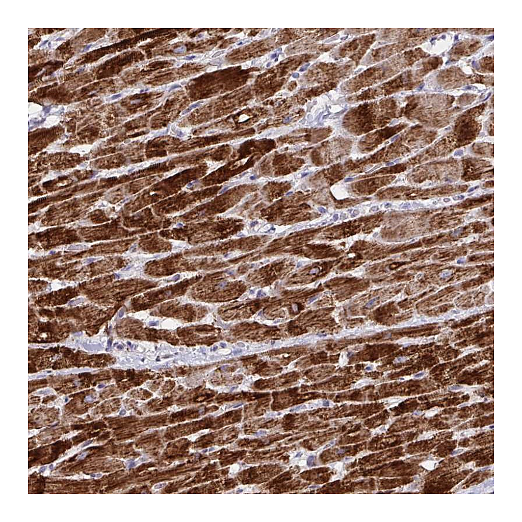 Atlas Antibodies Anti-DOK7 Antibody