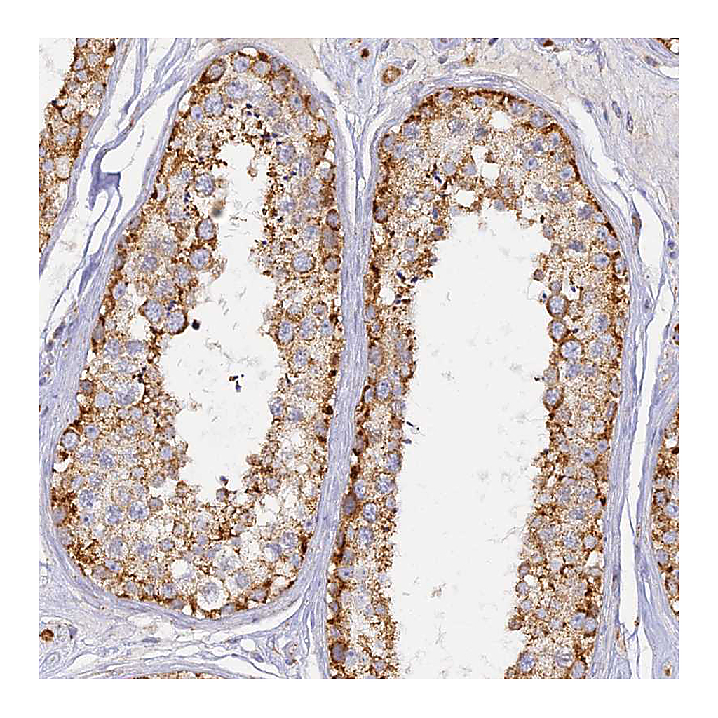 Atlas Antibodies Anti-DONSON Antibody