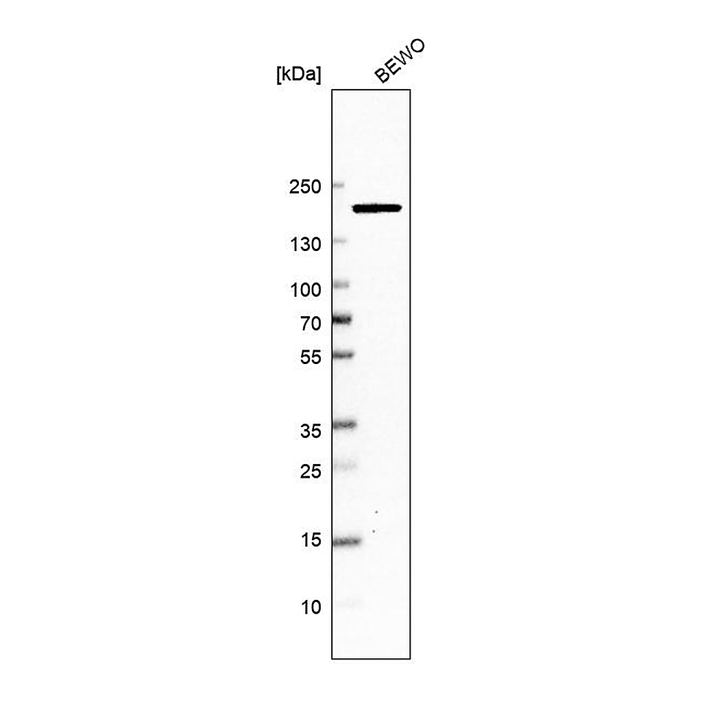 Atlas Antibodies Anti-DOT1L Antibody