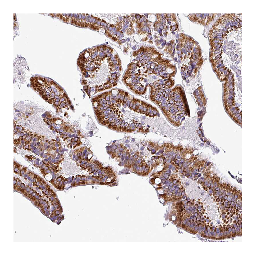 Atlas Antibodies Anti-DPAGT1 Antibody