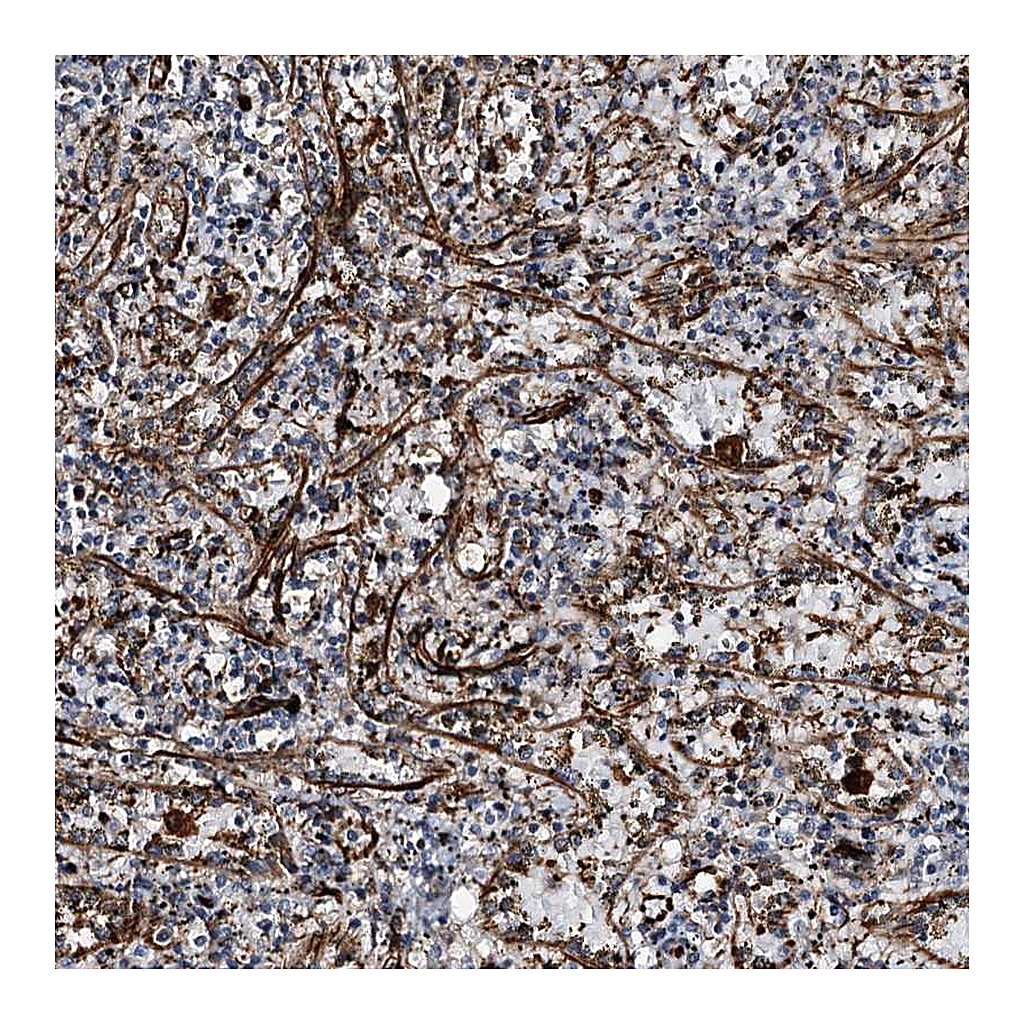 Atlas Antibodies Anti-DPEP2 Antibody