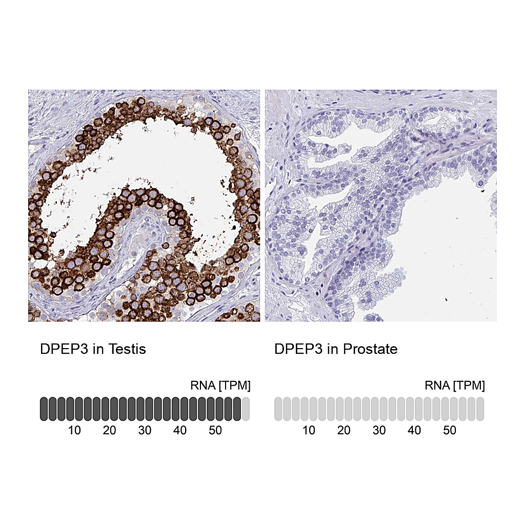Atlas Antibodies Anti-DPEP3 Antibody