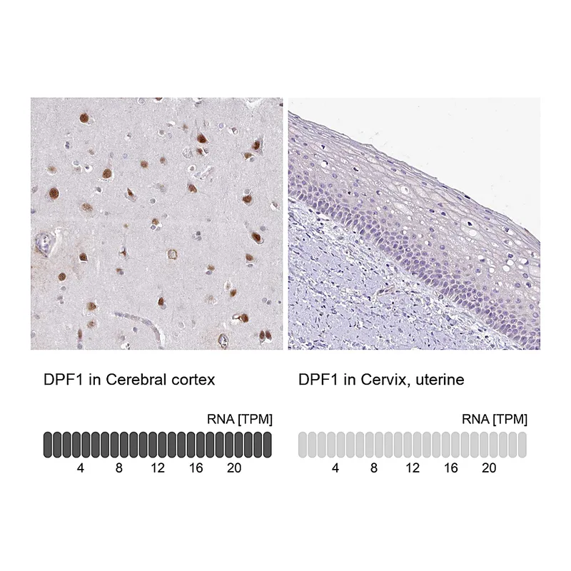 Atlas Antibodies Anti-DPF1 Antibody