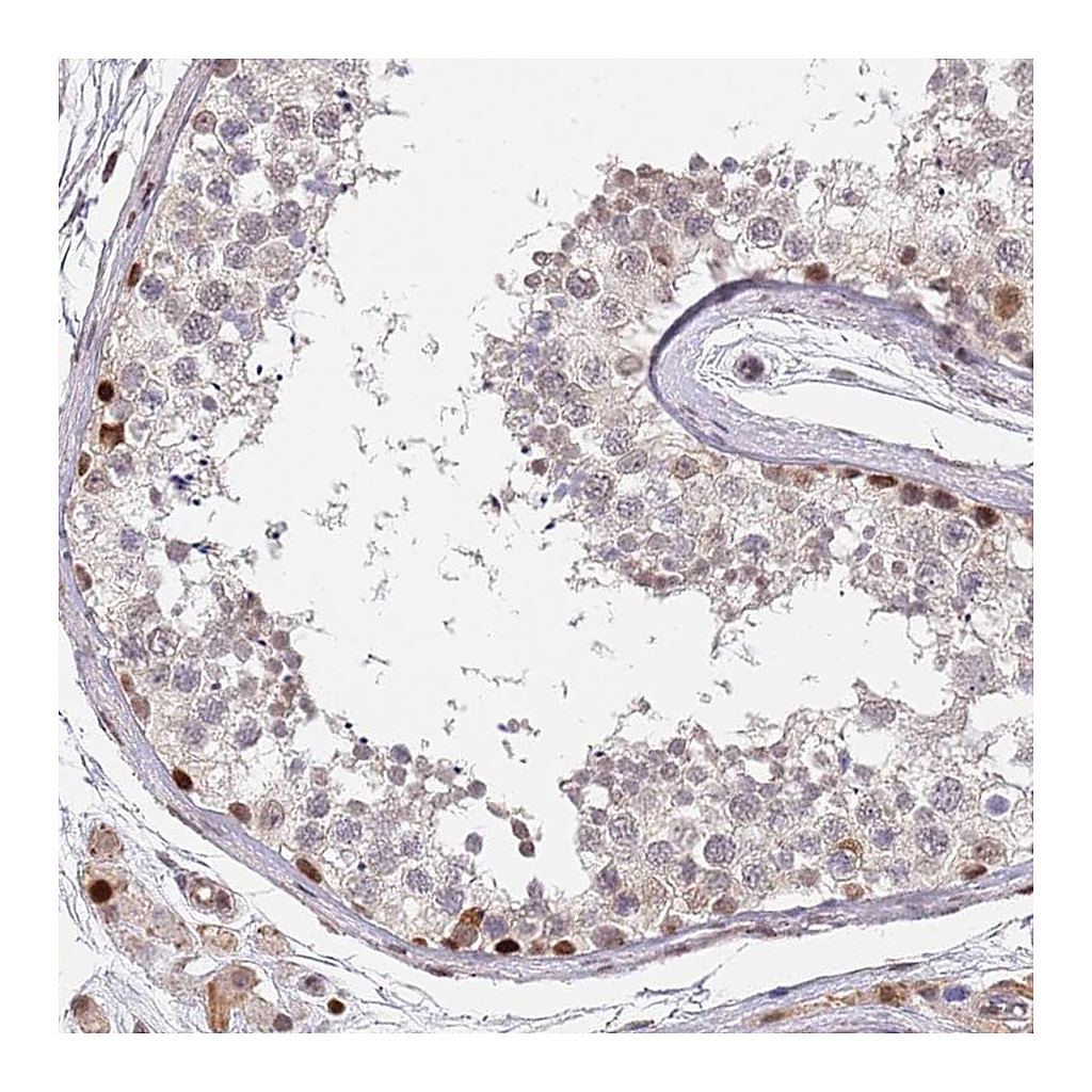 Atlas Antibodies Anti-DPH2 Antibody