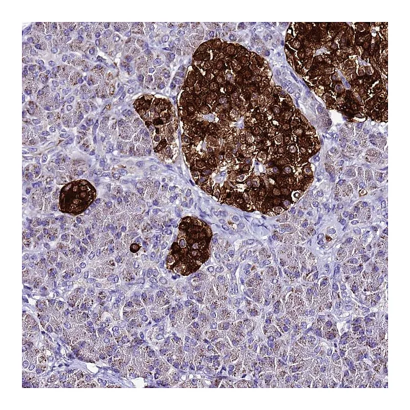 Atlas Antibodies Anti-DPH6 Antibody