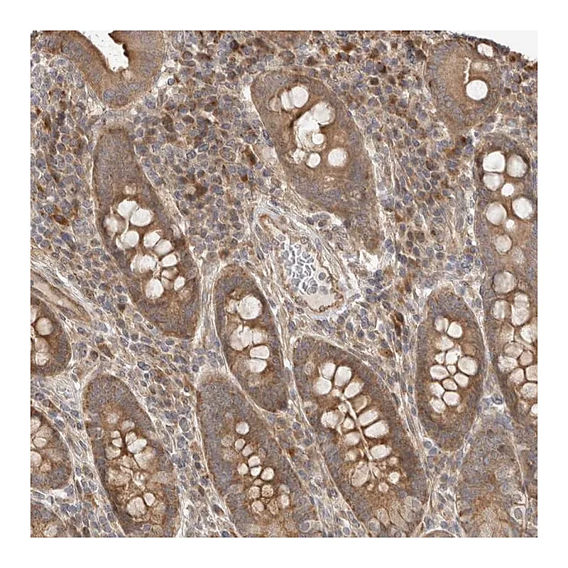Atlas Antibodies Anti-DPH7 Antibody
