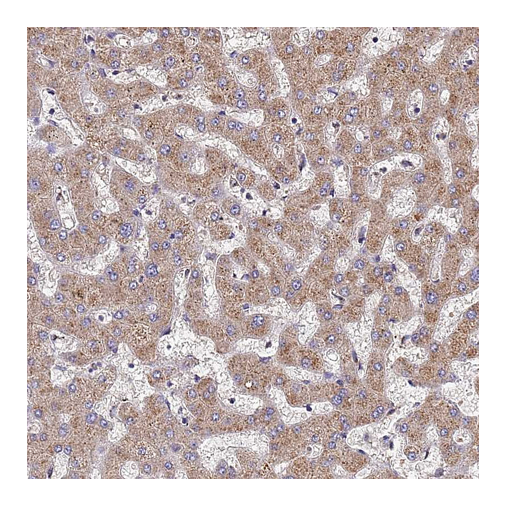 Atlas Antibodies Anti-DPH5 Antibody