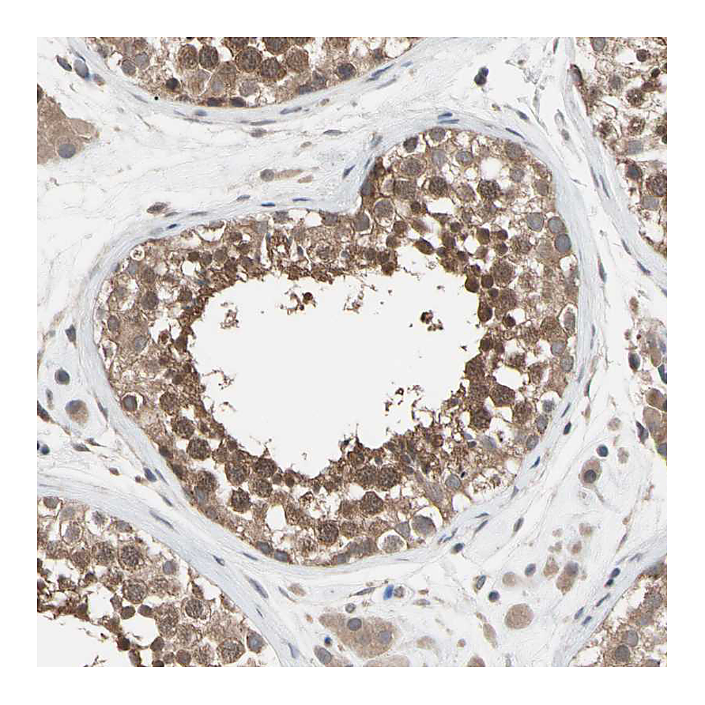 Atlas Antibodies Anti-DPP8 Antibody