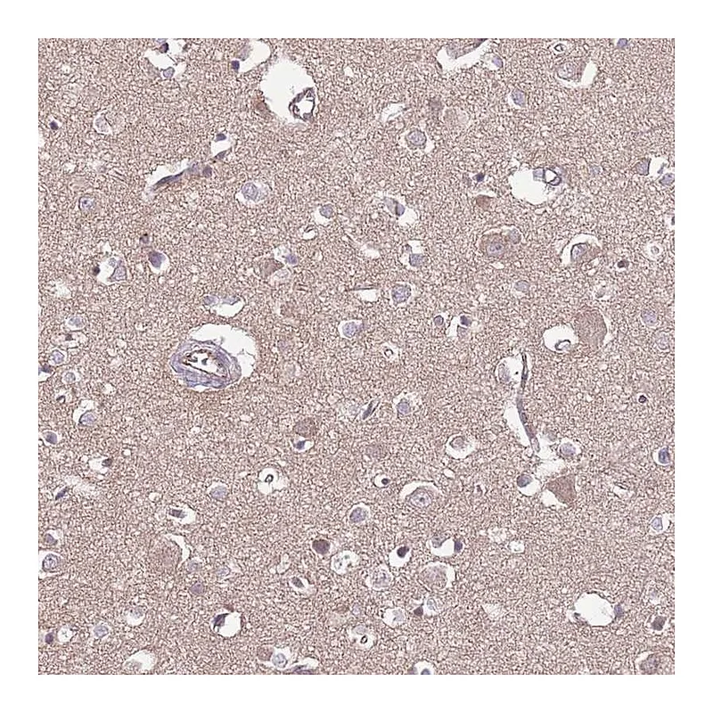 Atlas Antibodies Anti-DPP10 Antibody