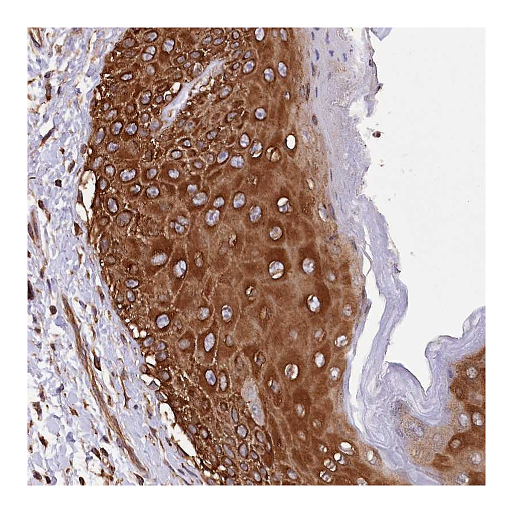 Atlas Antibodies Anti-DPP3 Antibody
