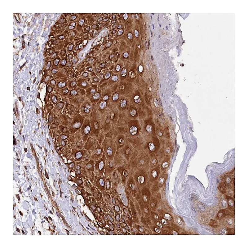 Atlas Antibodies Anti-DPP3 Antibody