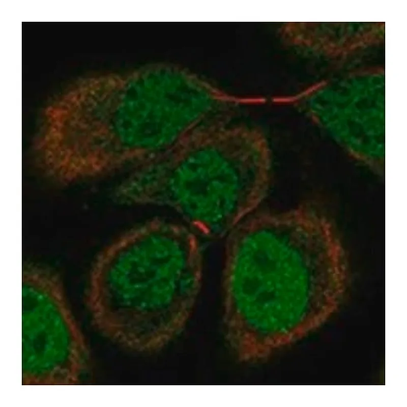 Merck Anti-OSBPL7 antibody produced in rabbit
