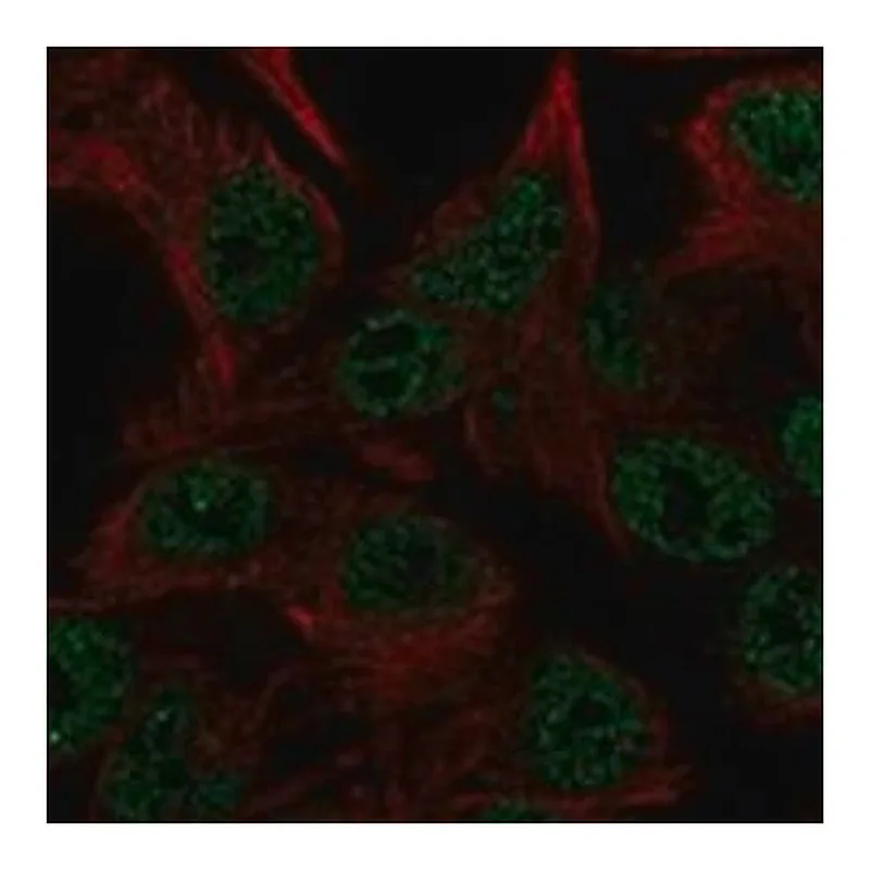 Merck Anti-CEMP1 antibody produced in rabbit