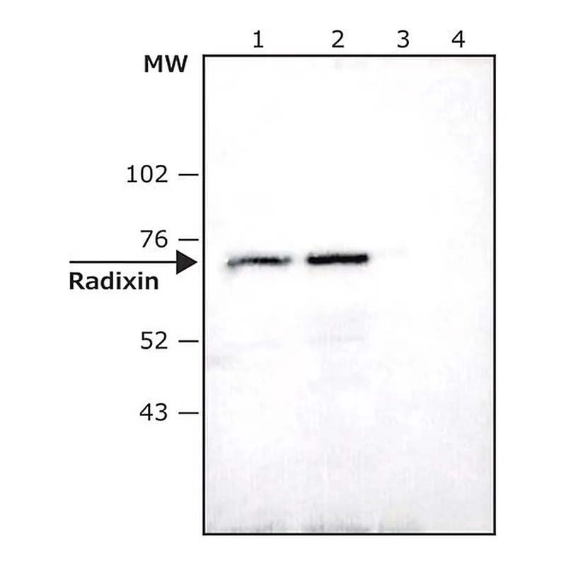 Merck Anti-Radixin antibody produced in rabbit