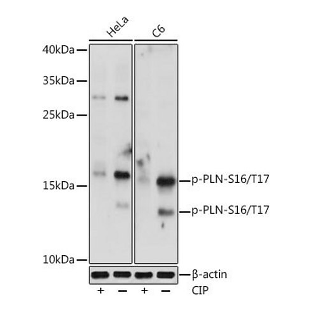 Merck Anti-Phospho-PLN-S16/T17 antibody produced in rabbit