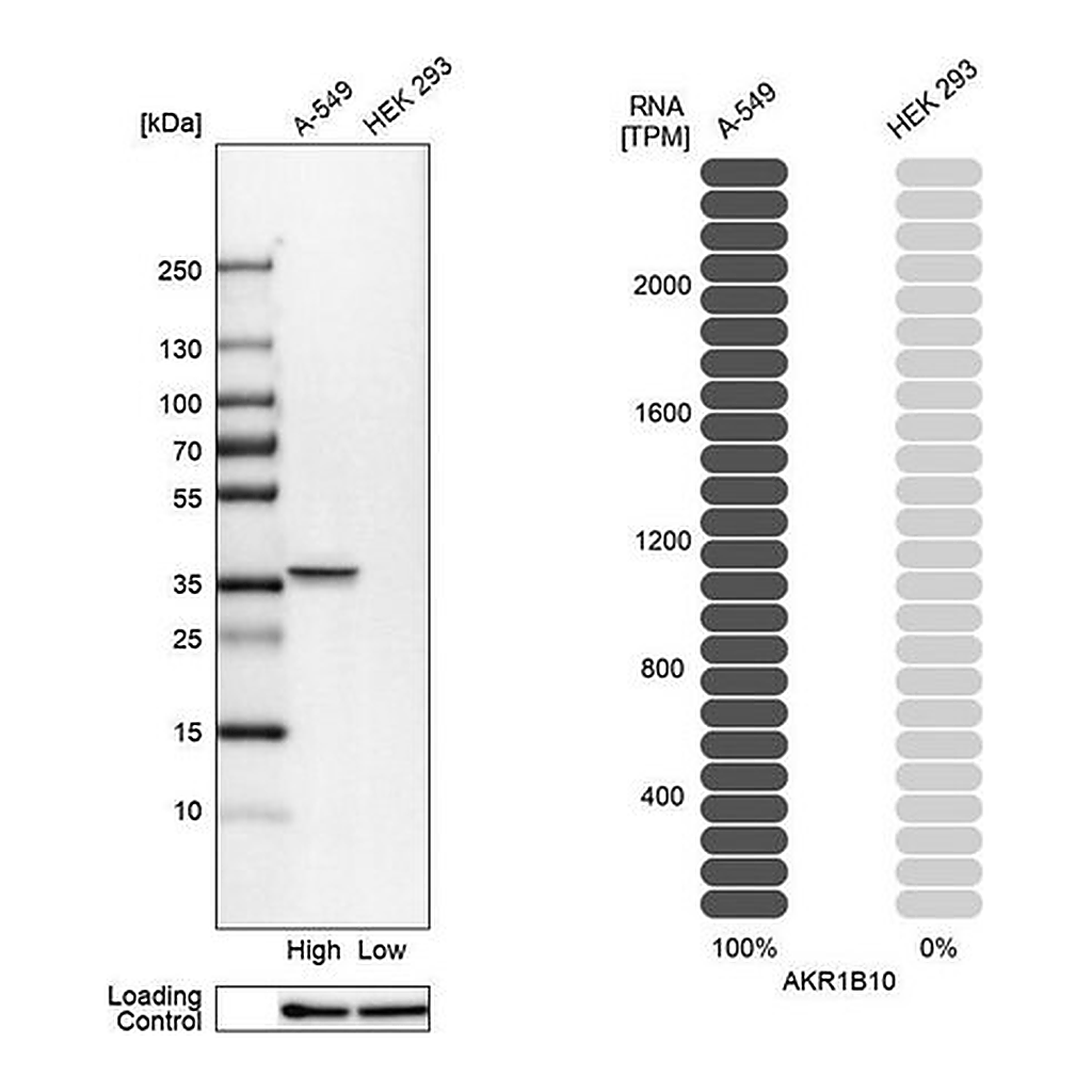 Merck Anti-AKR1B10 antibody produced in rabbit