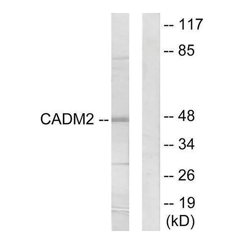 Merck Anti-CADM2 antibody produced in rabbit