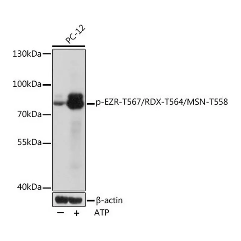 Merck Anti-Phospho-EZR-T567/RDX-T564/MSN-T558 antibody produced in rabbit