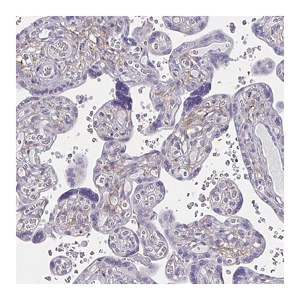 Merck Anti-ENPP1 antibody produced in rabbit