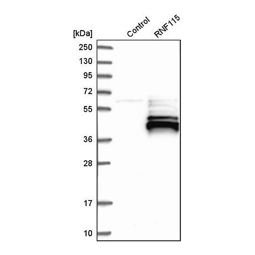 Merck Anti-RNF115 antibody produced in rabbit