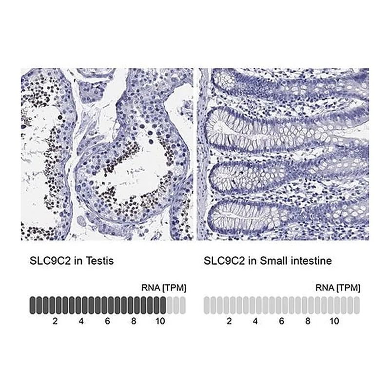 Merck Anti-SLC9C2 antibody produced in rabbit
