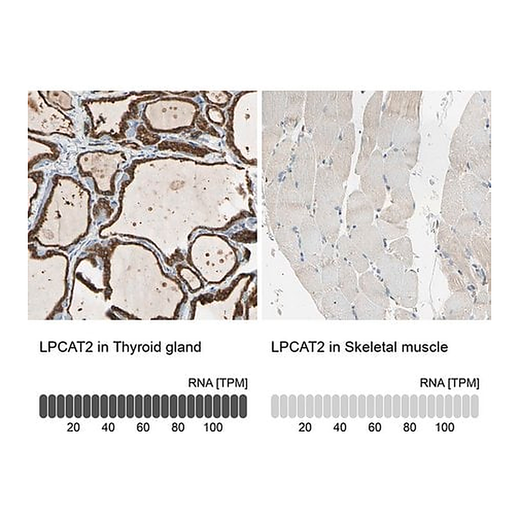 Merck Anti-LPCAT2 antibody produced in rabbit