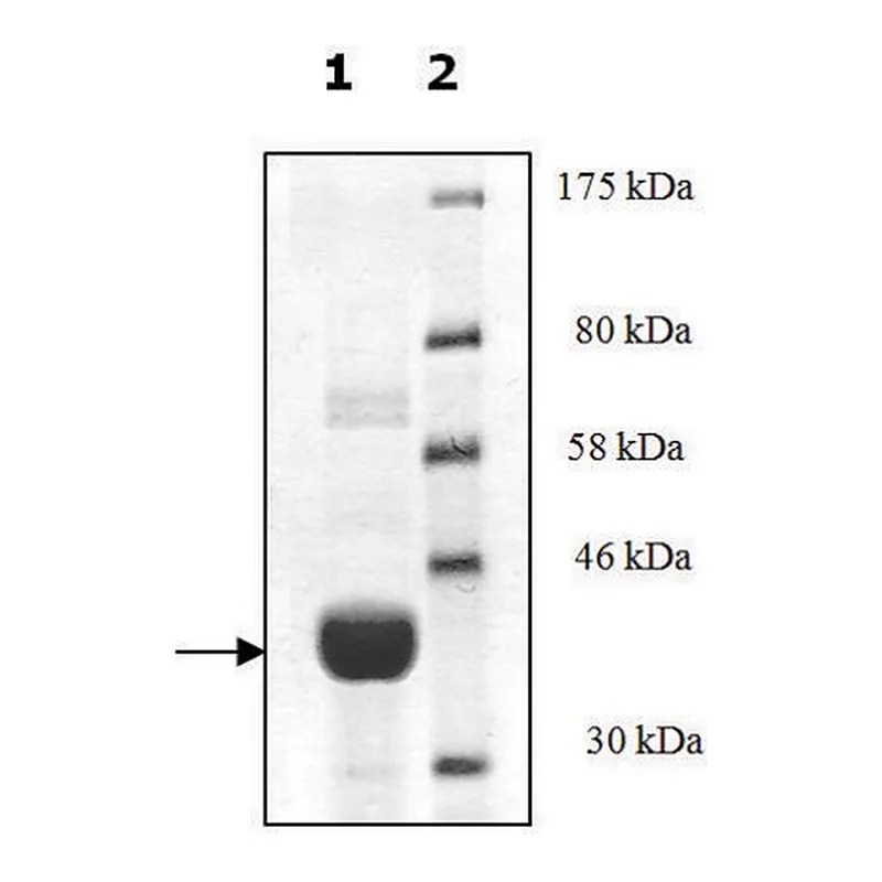 Merck T4 Beta-glucosyltransferase