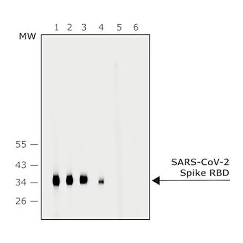 Merck Anti-SARS-COV-2-Spike-RBD region antibod