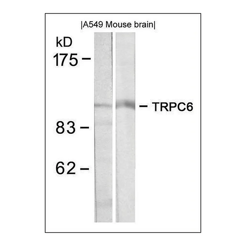Merck Anti-TRPC6 antibody produced in rabbit