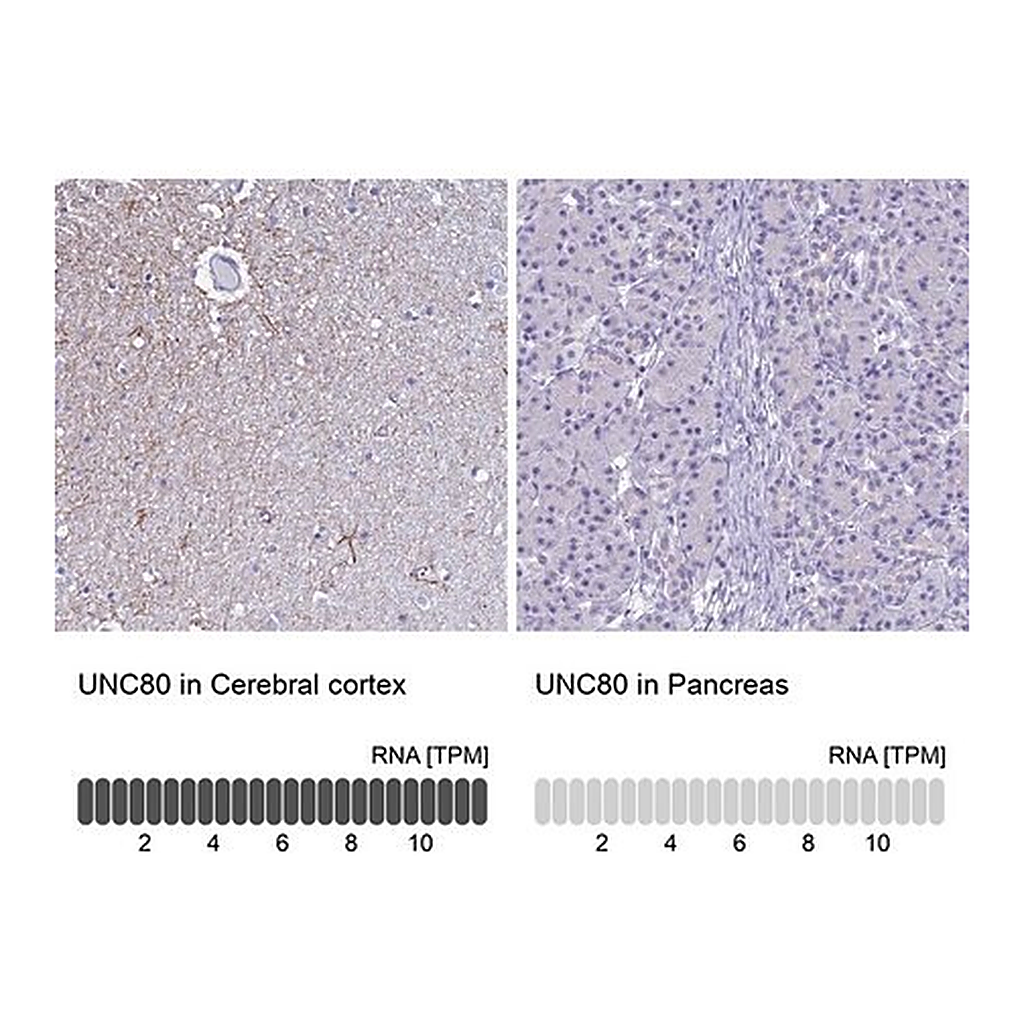 Merck Anti-UNC80 antibody produced in rabbit