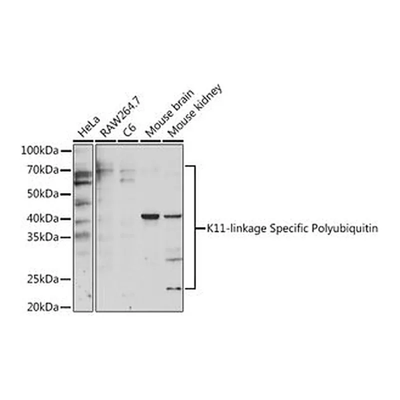 Merck Anti-K11-linkage Specific Polyubiquitin&