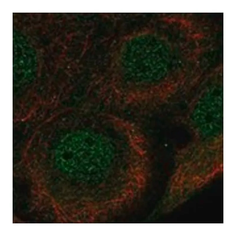 Merck Anti-VDR antibody produced in rabbit