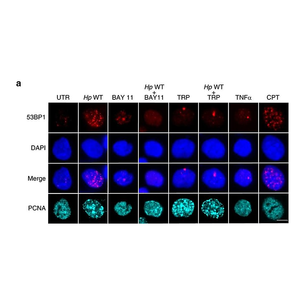 Thermo Fisher Scientific Goat anti-Rabbit IgG (H+L) Highly Cross-Adsorbed Secondary Antibody, Alexa Fluor 488