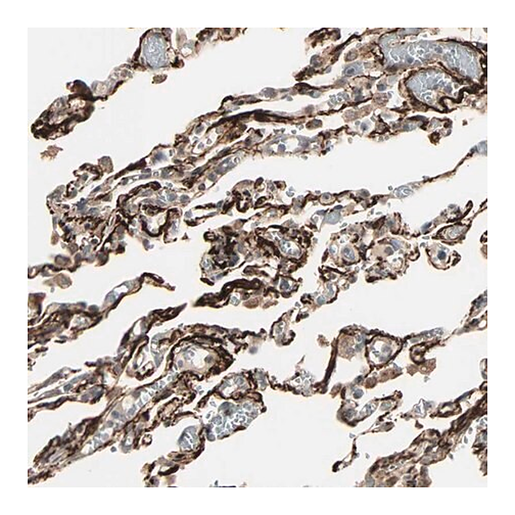 Merck Anti-CALCRL antibody produced in rabbit