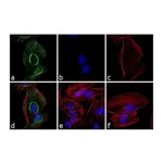 Thermo Fisher Scientific Goat anti-Rabbit IgG F(ab`)2 Secondary Antibody, FITC