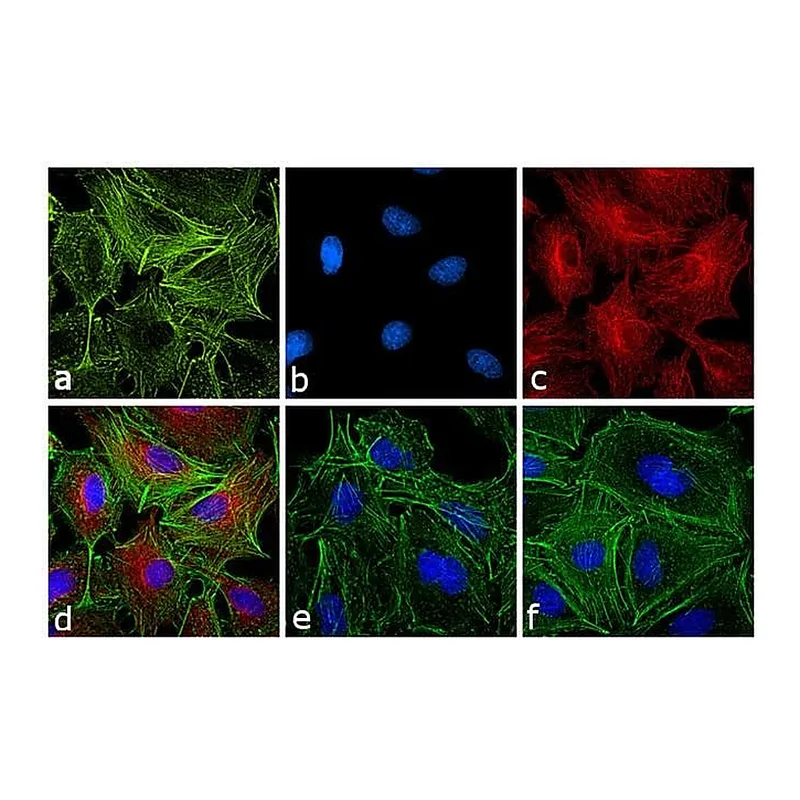 Thermo Fisher Scientific Rabbit anti-Rat IgG (H+L) Secondary Antibody, TRITC