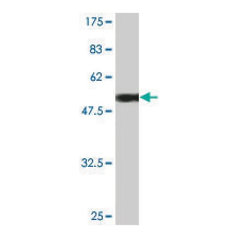 Merck Monoclonal Anti-UCHL1 antibody produced in mouse