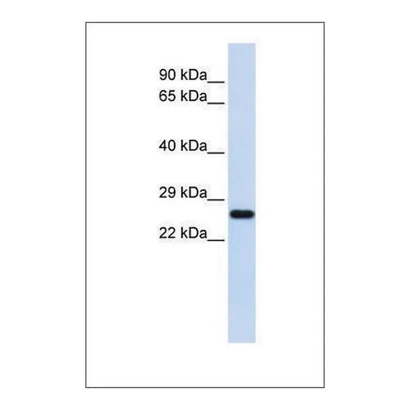 Merck Anti-SOD2 antibody produced in rabbit