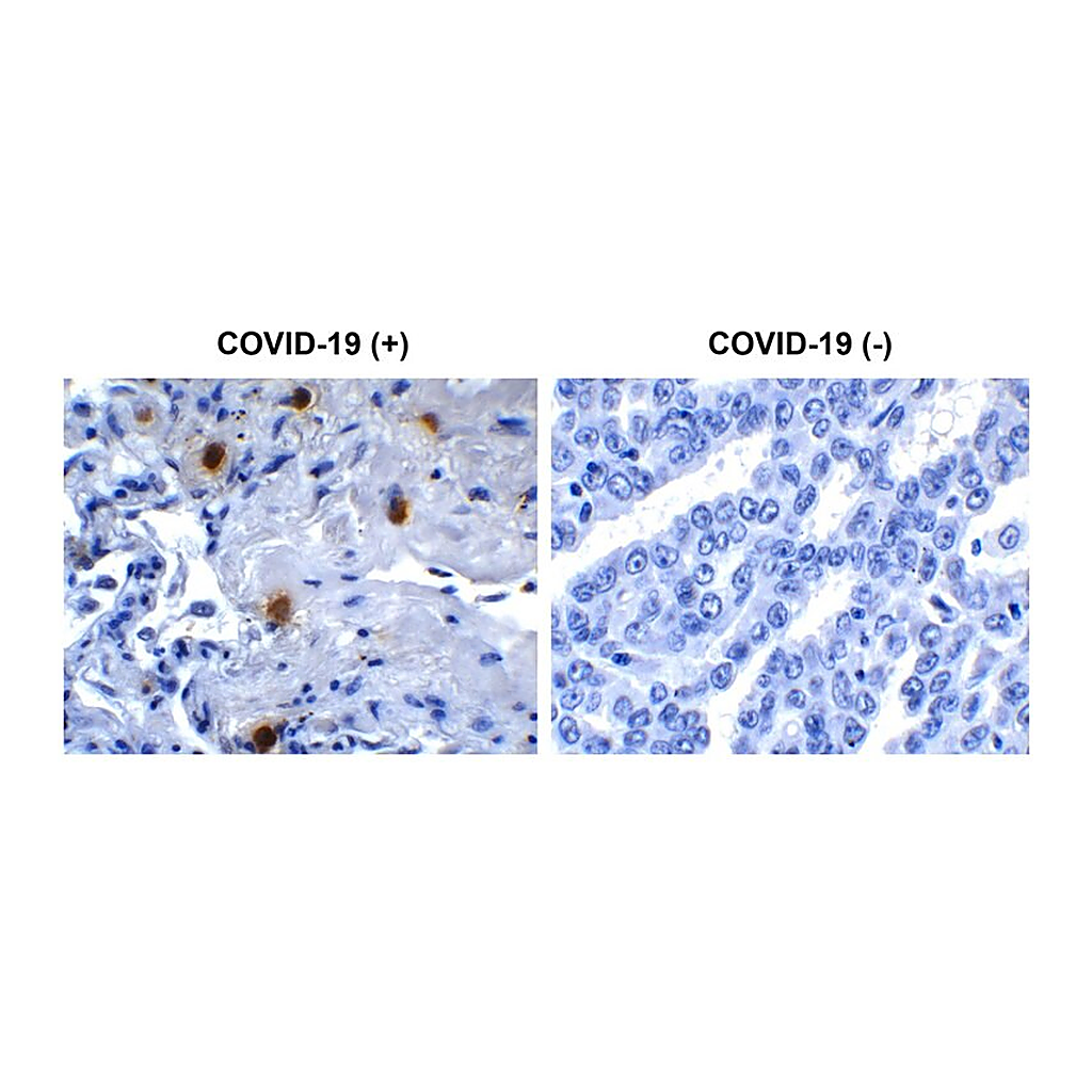 Merck Anti-SARS-CoV-2 (COVID-19) NSP10 antibody produced in rabbit