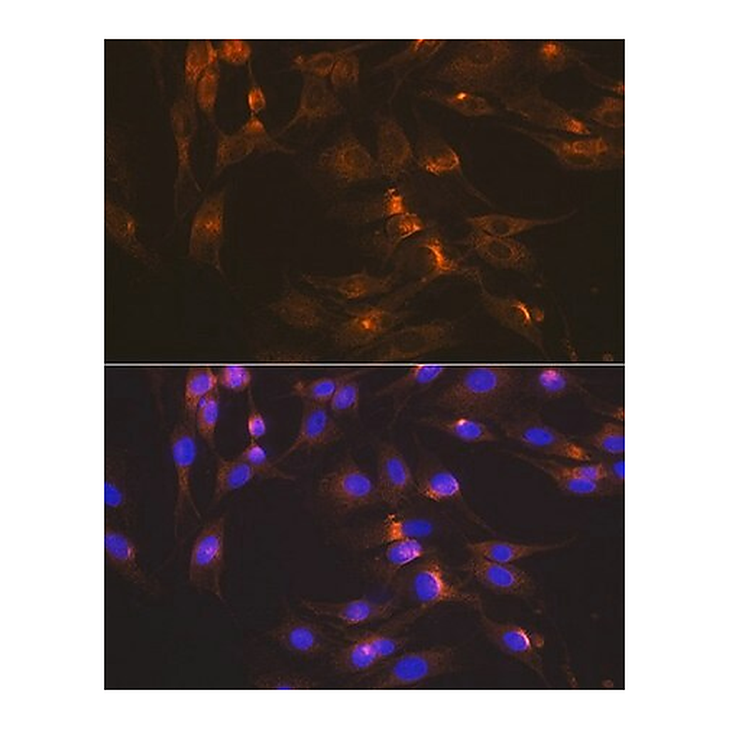 Merck Anti-GLUT2/SLC2A2 antibody produced in rabbit