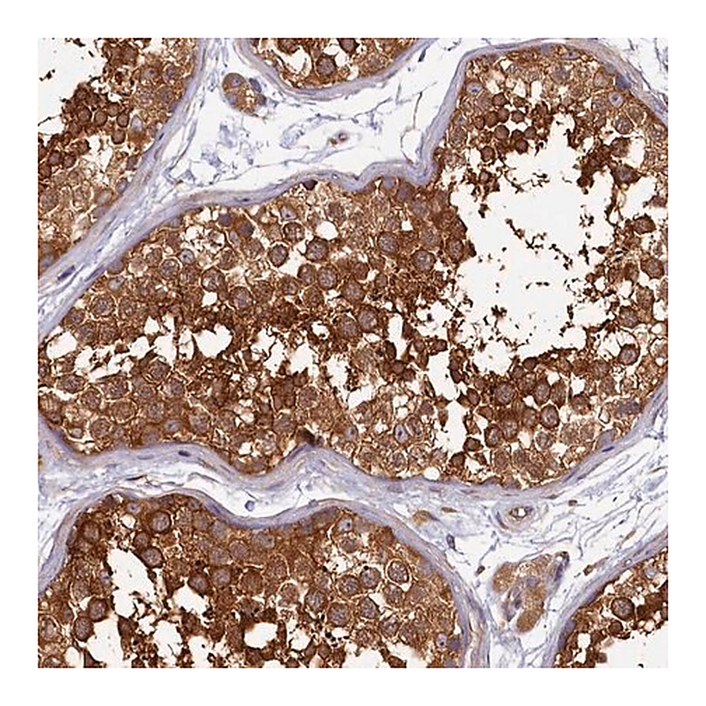 Merck Anti-PPIP5K1 antibody produced in rabbit