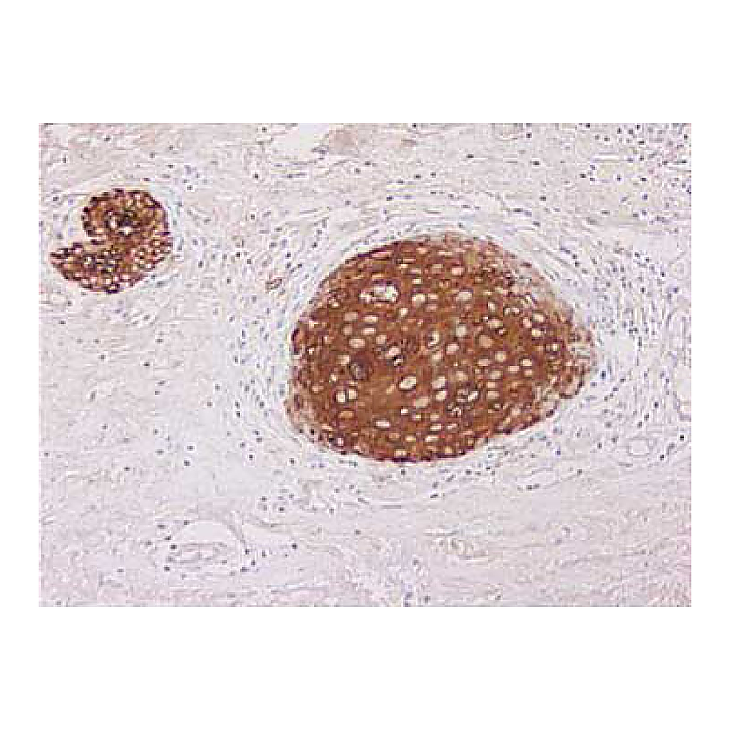 BD Purified Mouse Anti-Human MUC1 (CD227)