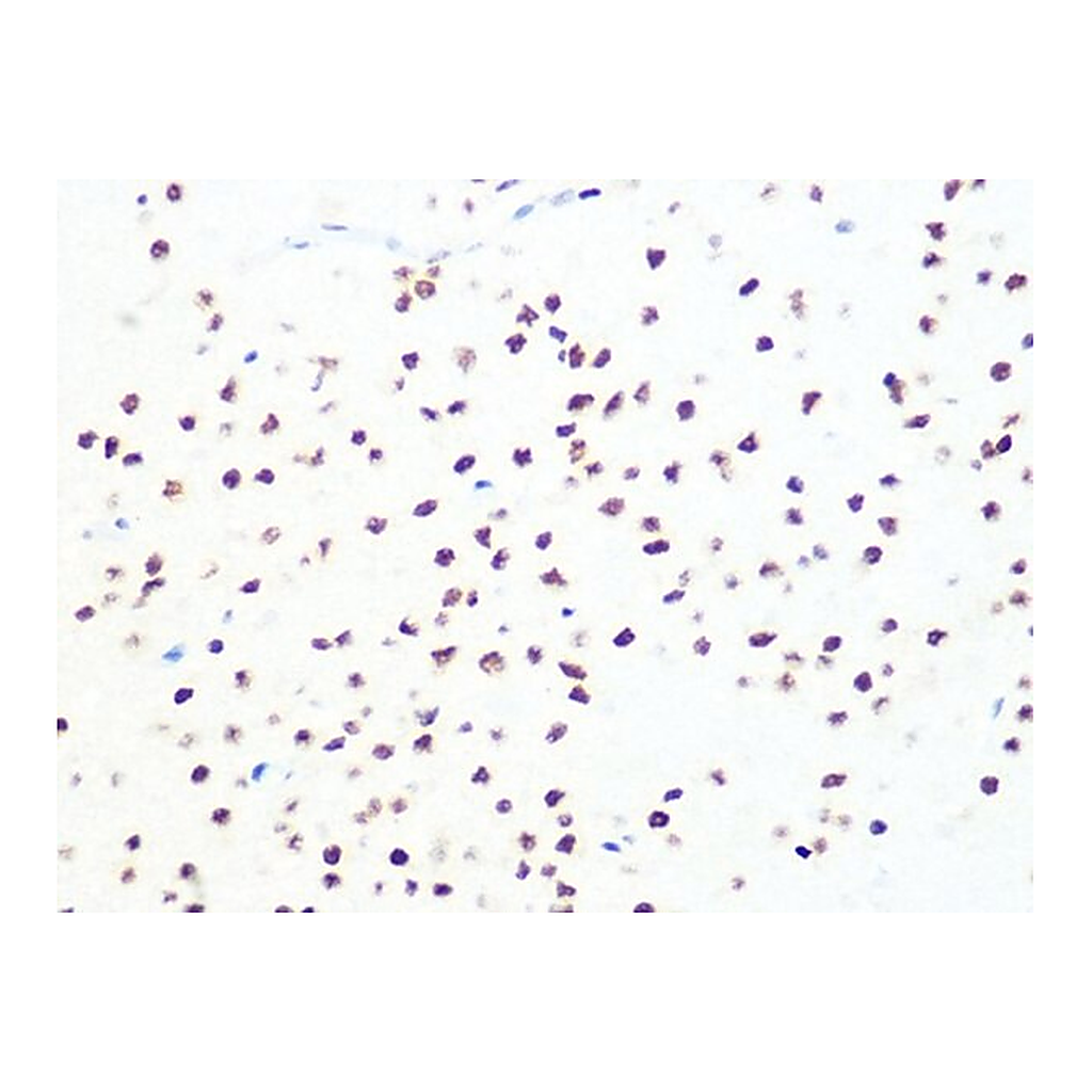 Merck Anti-DKC1 antibody produced in rabbit