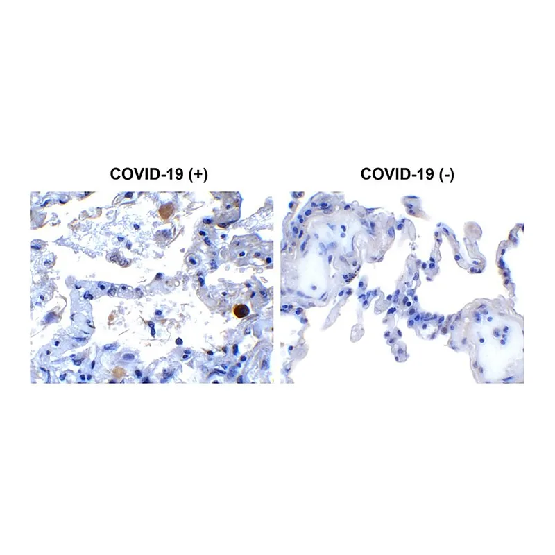 Merck Anti-SARS-CoV-2 (COVID-19) NSP13 (Helicase) antibody produced in rabbit