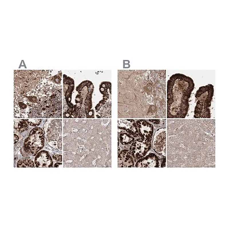 Merck Anti-LRPPRC antibody produced in rabbit