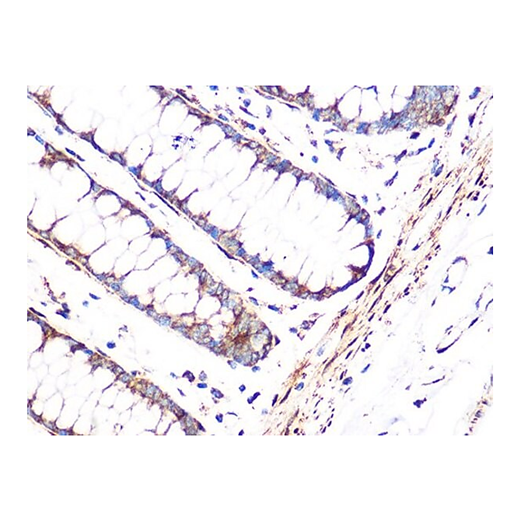 Merck Anti-FHL1 antibody produced in rabbit