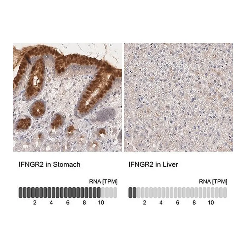 Merck Anti-IFNGR2 antibody produced in rabbit