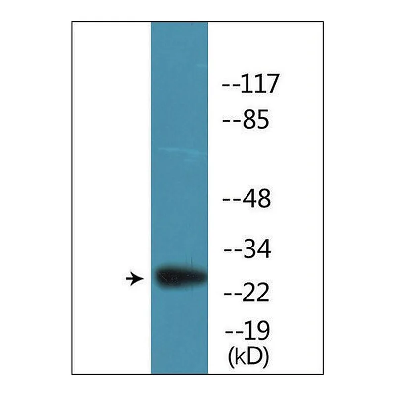 Merck Anti-phospho-BCL-2 (pSer87) antibody produced in rabbit